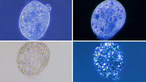 Four times a ciliate imaged with a different microscopy technique.