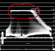 Der Canopus - Unterschied : effektmsmc