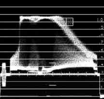 Der Canopus - Unterschied : effektorg